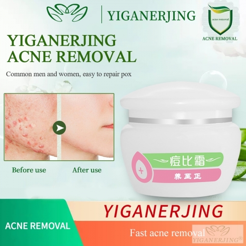 YANGZHIZHENG Acne Treatment Cream, Rapid Soothing and Repair, Refreshing Skin, 30g Portable Size. The Ideal Choice for Treating Acne Problems.